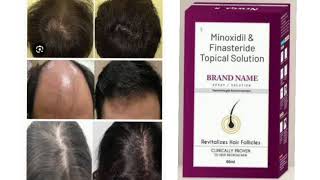 BRAND NAME SOLUTION Minoxidil amp Finasteride Topical Solution Revitalizes Hair Follicles [upl. by Leahpar610]