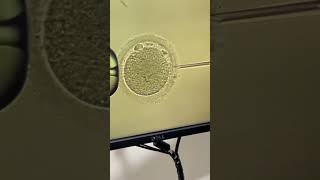 Intracytoplasmic Sperm Injection ICSI [upl. by Kcinnay462]