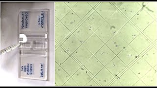 Semen Analysis Test Lab  Sperm Count Test [upl. by Addis]