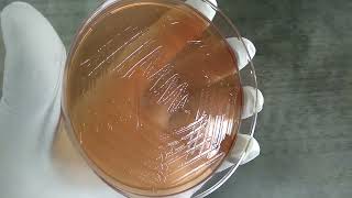 Vibrio cholerae colony morphology on Macconkey agar Demonstration [upl. by Thorstein]