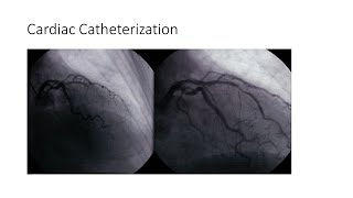 Cardiac Catheterization [upl. by Eckblad311]