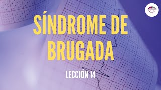 14 SÍNDROME DE BRUGADA ELECTROCARDIOGRAFÍA [upl. by Metabel798]