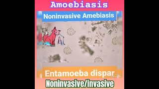 Noninvasive Amoebiasis E dispar 🤔 👍Parasitology👌🔬✅ [upl. by Gaven]