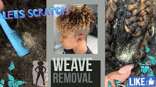 Stephs dandruff sew in removal [upl. by Waugh]