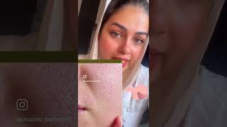 Open pore during makeup  makeup artist [upl. by Grew]