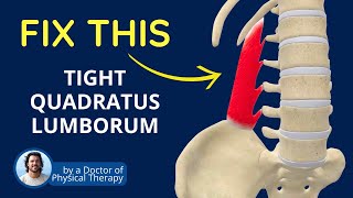 Is a Tight QL Causing Your Back Pain  Quadratus Lumborum Muscle Tightness [upl. by Jaworski]