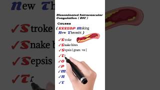 Causes of Disseminated Intravascular Coagulation  DIC [upl. by Hock]