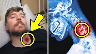 MrBeasts Life Changing Surgery sad [upl. by Dray171]