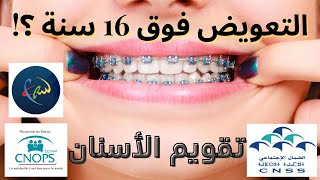 CNSS CNOPS كل ما يخص تعويضات تقويم الأسنان 🦷 [upl. by Ael]