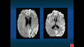 RADIOLOGY EXAM CASES [upl. by Annoyi]