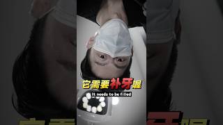 牙齿有蛀牙就需要补牙 蛀牙 dentist 补牙 牙医 牙科 知识 [upl. by Stephie]