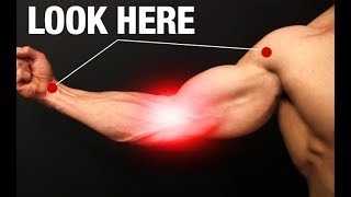 How to Fix Elbow Pain ONE SIMPLE EXERCISE [upl. by Ilak]