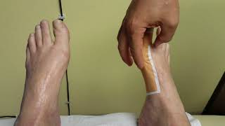 Foot  1st metatarsal phalangeal joint taping [upl. by Tine341]