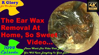 The Ear Wax Removal At Home Sweet Video Relaxing😍New Video Ear Wax Removal 1094 ear newvideo [upl. by Quint]