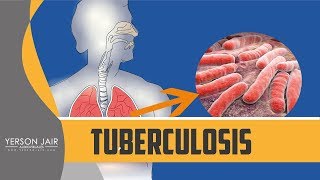 prevención de la tuberculosis [upl. by Han397]