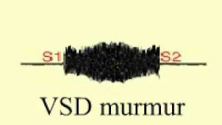 Ventricular Septal Defect murmur [upl. by Assille]