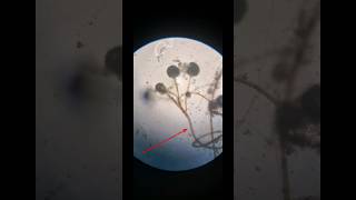 Mucor  mold  Saprophytic  fungus c³ experiment [upl. by Esinyt207]