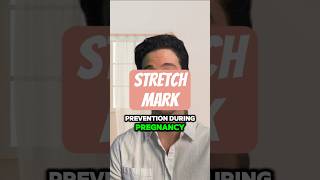 Stretch Mark Prevention During Pregnancy From A Dermatologist shorts pregnancytips [upl. by Munmro]