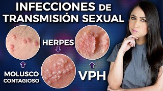 Infecciones de Transmisión Sexual⚠️ l Lo que tienes que saber 👩🏻‍⚕️ [upl. by Nneb]