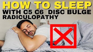 Ep19 How To Sleep With C5 C6 Disc Bulge Radiculopathy  Dr Walter Salubro Chiropractor in Vaughan [upl. by Euqilegna617]