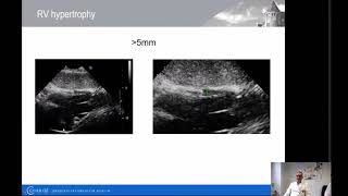 Echokardiographie bei Pulmonaler Hypertonie  Charité  Prof Dr med Frank Edelmann [upl. by Hardej]