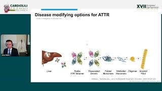 New pharmacological targets in amyloidosis cardiomyopathy What is the future  José Nativi [upl. by Aonehc289]