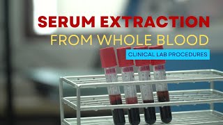 Serum Extraction from Whole Blood [upl. by Liagabba]