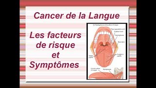 Cancer de la langue  Facteurs de risque et Symptômes [upl. by Osmond]