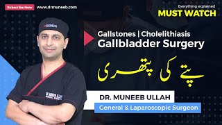 Gallstones  Cholelithiasis  Gallbladder Surgery  Everything explained MUST WATCH [upl. by Rhiana480]