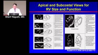 Assessment of RV Function Sherif Nagueh MD February 14 2017 [upl. by Irami]