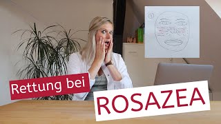 Rettung bei Rosazea  Couperose  Vorbeugung  Triggerfaktoren  Pflegetipps  Therapie [upl. by Mmada]