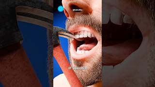 How to repair a broken tooth😬 shorts youtubeshorts [upl. by Yerffoej]