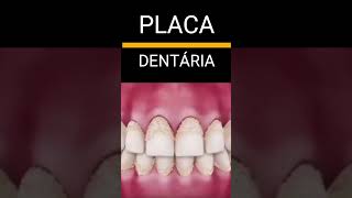 PELÍCULA ADQUIRIDA X PLACA DENTAL shorts shortfeed shortvideo odonto odontologia calculodental [upl. by Aydan]