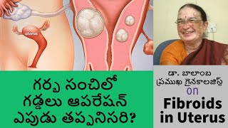 గర్భసంచిలో గడ్డలు  ఎపుడు ప్రమాదకరం  HMB Liv Channel  Dr Balamba Gynecologist amp Obstetrician [upl. by Adile998]