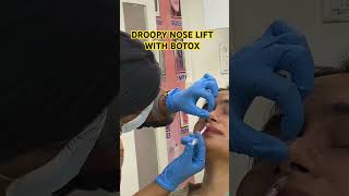 Non surgical nose tip lift music glutathione botox botulinumtoxin [upl. by Nepets]