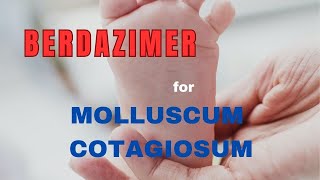 MOLLUSCUM CONTAGIOSUM Treatment update  BERDAZIMER GEL [upl. by Marisa]