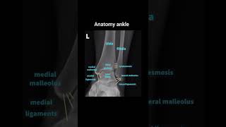 Anatomi ankle joint xray radiology anatomy [upl. by Ees]