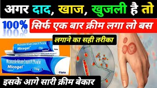 दाद खाज खुजली की बेस्ट क्रीम  micogel cream  micogel cream uses in hindi  miconazole nitrate [upl. by Tipton]