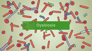 Fecal microbiotabased treatments for C diff infection [upl. by Heath]