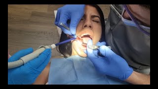 Dental Injection  Extraction  Dent Economy  Dentist  Dental [upl. by Namor]