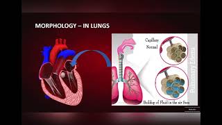 LEFT SIDED HEART FAILURE Causes Symptoms and Morphology [upl. by Criswell355]