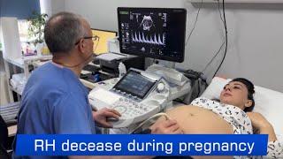 RH decease during pregnancy [upl. by Diarmit]