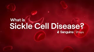 What is Sickle Cell Disease  SanguinaDrops [upl. by Dustman]