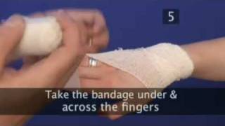 how to bandage a hand [upl. by Kalli]