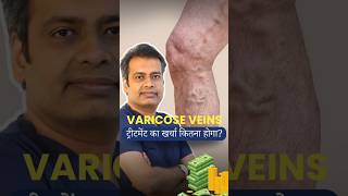 Whats the REAL Cost of Varicose Veins Treatment varicoseveins budget shorts [upl. by Nedrah]