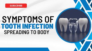 Tooth Infection Spreads Recognizing the Symptoms and What to Do [upl. by Polk]