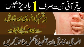 Kharish Alerji Ka Ilaj Best wazifa for Itchy Skin Treatment Islamic Adab [upl. by Lleraj585]