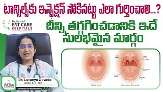 టాన్సిల్స్‌ ఎలా గుర్తించాలి  Tonsillitis  Symptoms Causes  Dr Harika ENT Care Hospital [upl. by Tutto93]