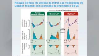 Recommendations for the Evaluation of Left Ventricular Diastolic Function by Echocardiography [upl. by Oruntha]