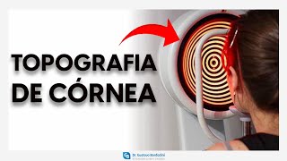 Topografia de córnea  DrGustavo Bonfadini [upl. by Francois]